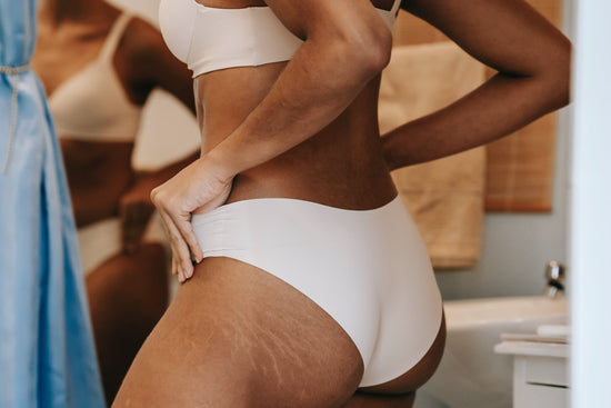 Is Organic Castor Oil Good for Treating Stretch Marks?
